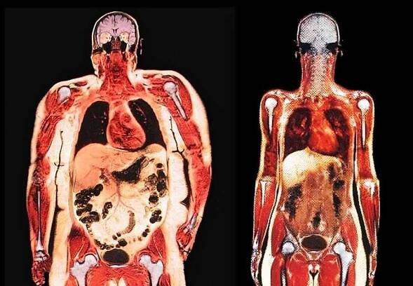 Adaptivní termogeneze, proč se ztrácejí kilogramy / Články