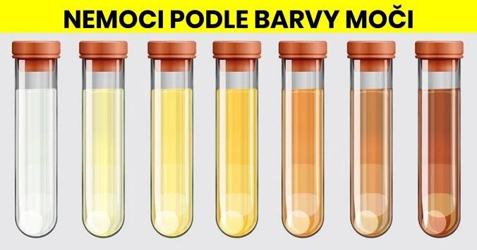 Toto jsou všechny VAROVNÉ odstíny moči, které upozorňují na vážné zdravotní problémy, jenž akutně trápí vaše tělo!
