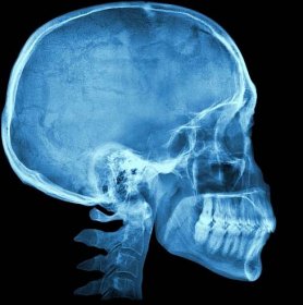 rentgenový snímek lidské lebky - lebka člověka - stock snímky, obrázky a fotky