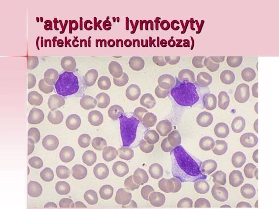 PPT - Patofyziologie krvetvorby PowerPoint Presentation, free download - ID:5328389