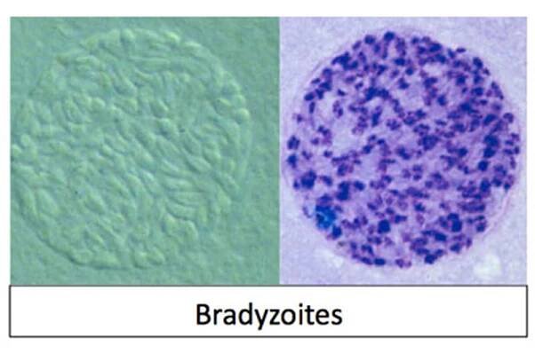 800X600 Toxoplasma Bradyzoites