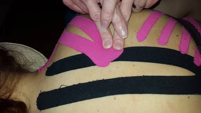 Tejpování – Kinesiotaping a Lymfotaping | Masérská škola INPROV Brno