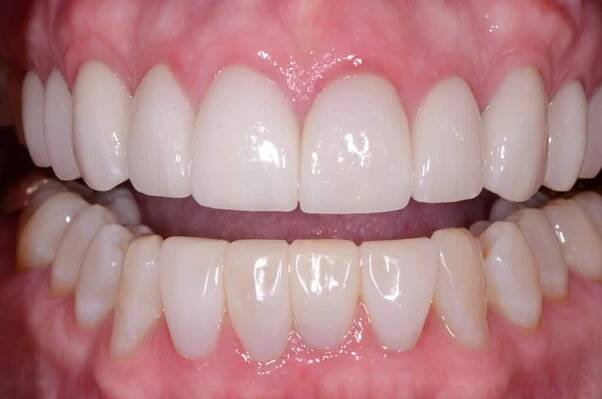 Smile Gallery Cherrywood Dental Care