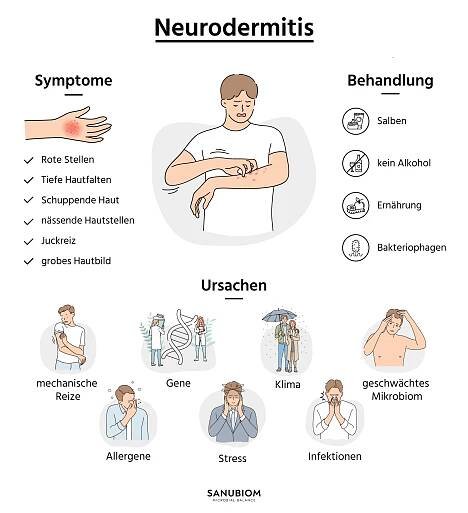 Leitsymptome bei Neurodermitis treten bei Betroffenen verschiedener Altersgruppen in vergleichbarer Form auf
