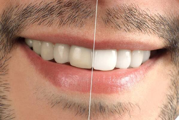 Teeth. Dental. Wide sincere smile