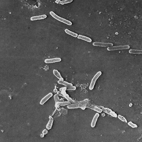 Weight Loss Agents: Utah Issues Warning About Weight-loss Surgery in Mexico After Patient Dies From Antibiotic-resistant Infection