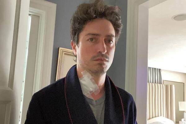 Superstore's Ben Feldman Wrote a Will Before Undergoing Spinal Surgery: 'It Was Horrifying'