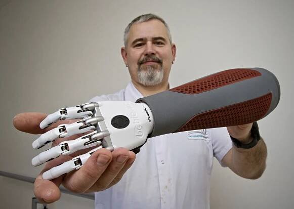Robotická protéza z 3D tisku? Na Západočeské univerzitě žádný problém