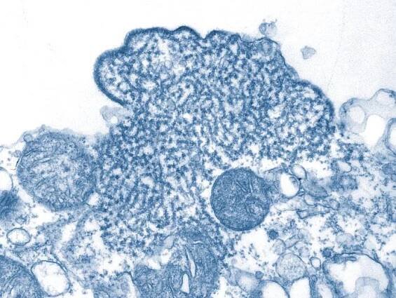 Nipah-Virus – Wikipedia