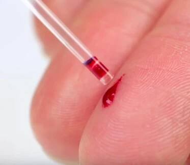 Vyšetření hladiny CRP v krvi - test na C-reaktivní protein