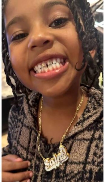 Saint West Wears LV Tooth Bling Kim Kardashian 2