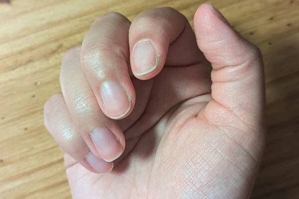 A close-up of a posed hand before using the Essie Hard to Resist Nail Strengthener Treatment