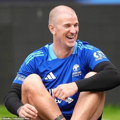 Joe Hart was in good spirits as he showed off the initial result of a hair transplant on Friday