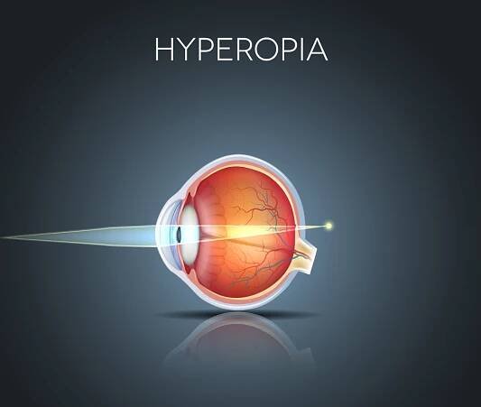 9 Causes of Blurred or Distorted Vision | Better Vision Guide