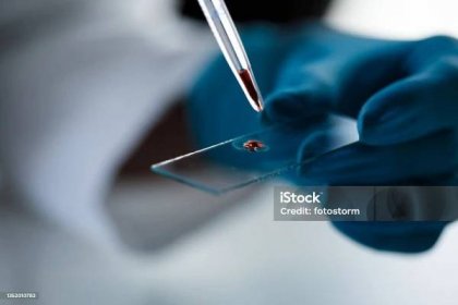Laboratorní technologie uvedení kapky krve, s pipetou, na mikroskopický snímek - Bez autorských poplatků Krev Stock fotka