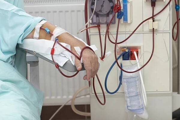 dialýza zdravotní medicína ledviny - hemodialýza - stock snímky, obrázky a fotky
