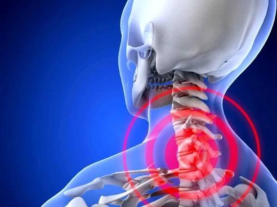 bolest krku s osteochondrózou