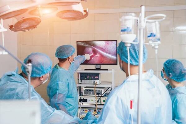 Proces operace gynekologické operaci laparoskopickou technikou. Skupina lékařů v operační místnosti s vybavením chirurgie. Pozadí — Stock obrázek