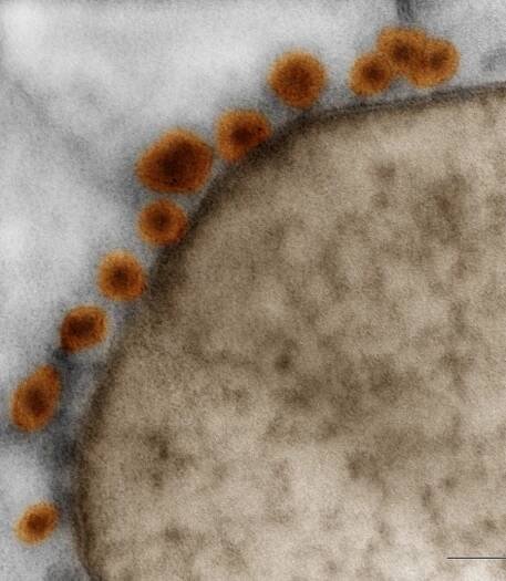 zika attached to cell membrane
