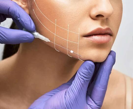 Introduction to PDO Thread Lifts - Restorative Health