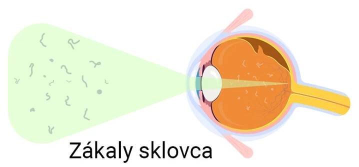 Zákaly sklovca - Vidissimo
