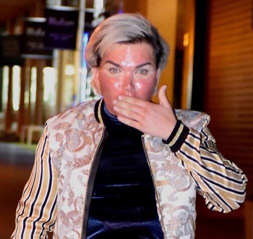 Rodrigo Alves - chemický peeling 2
