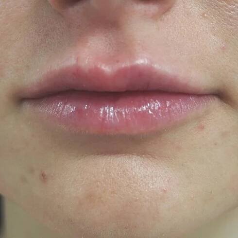 Image after