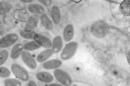 mikroskopický obraz infekčního viru. - dna virus - stock snímky, obrázky a fotky