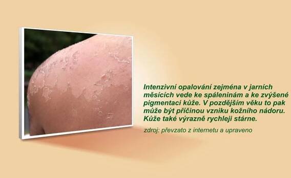 02-0195 - spaleni kuze