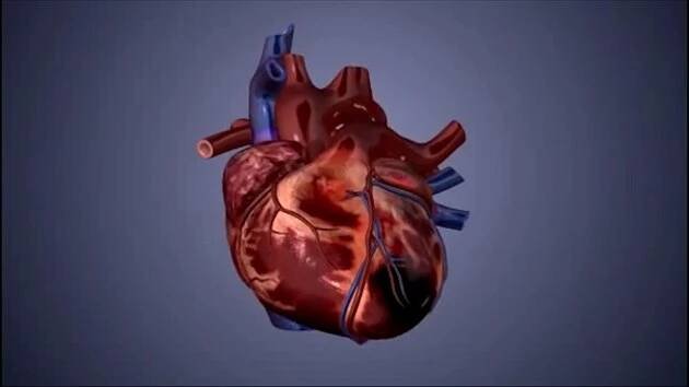 Infarkt, cévní mozková příhoda. Jak tělo chránit před kornatěním tepen