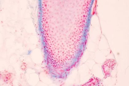 Skalp a vlasové folikuly člověka pod mikroskopem v laboratoři. — Stock obrázek