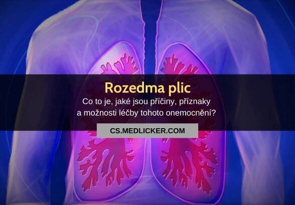 Plicní emfyzém (rozedma plic): příčiny, příznaky, diagnostika a léčba