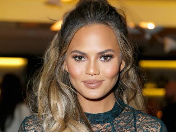 Chrissy Teigen's Fuller Lips Are an Allergic Reaction, Not Filler - Photos