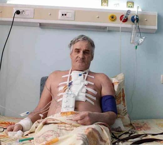 Operace bypassu koronární arterie a pooperační období / Kardiologie | Užitečné informace a tipy na péči o sebe. Zdraví