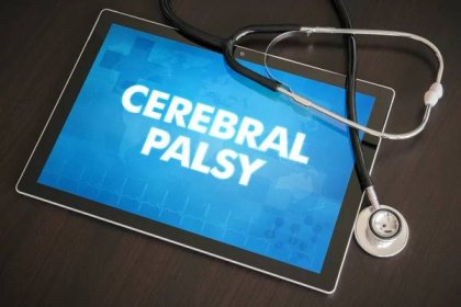 Later Administration of Prenatal Magnesium Sulfate Does Not Reduce Cerebral Palsy 