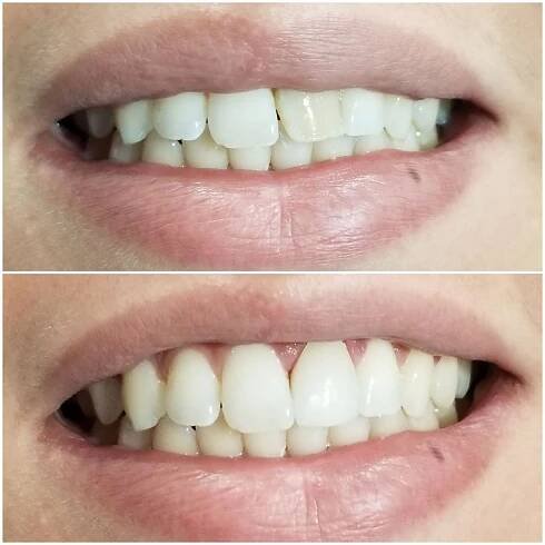Smiles Gallery | WOW Dental | Detroit, Michigan 