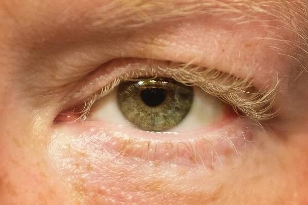 Do Eyelashes Grow Back?