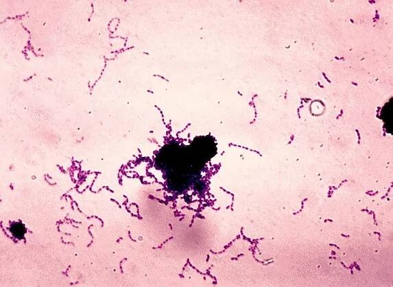 Streptococcus mutans – Wikipedie