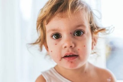 ŽENA-IN - Neštovice a jiné nemoci: Čím zabavit dítko, když musí být doma?
