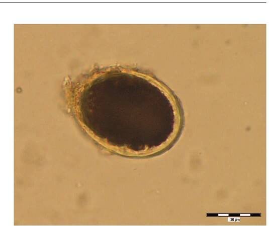 Figure 9. Presumably Ancylostoma duodenale, sample No. 90, flotation Clevage underneath suggests it could be the hookworm egg. 
