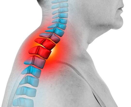 bolest krku, ischias a skolióza v krční páteři izolované na bílém pozadí, koncept léčby chiropraktikem - lidský krk - stock snímky, obrázky a fotky