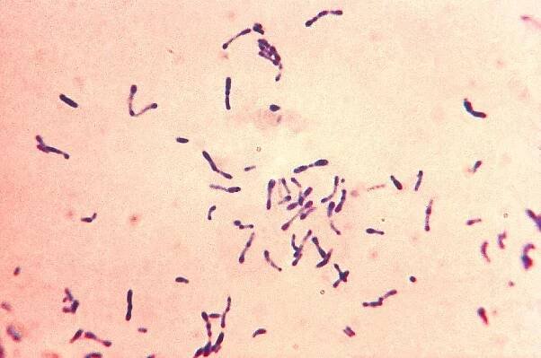 Záškrt (diftérie) – bakteriální infekce – příznaky, příčiny a léčba