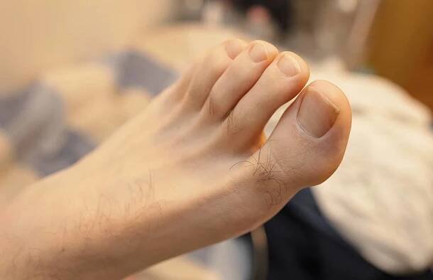 Ztráta ochlupení, otok palce nebo změna tvaru nehtů? Co vám prozradí nehty a prsty na nohou? - AAzdraví.cz