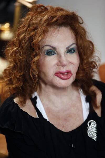Stalloneho matka Jackie Stallone, která propadla plastikám