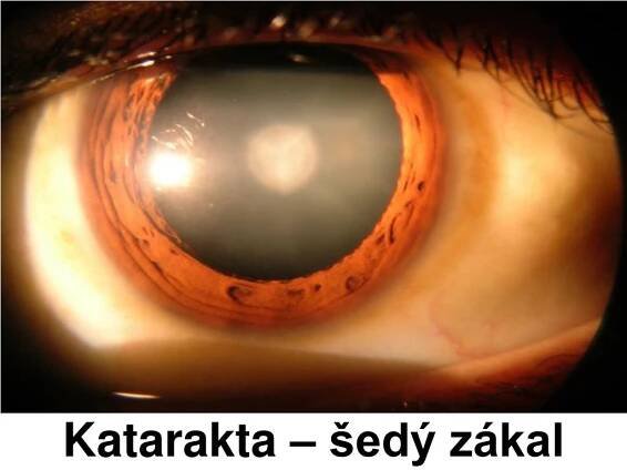 PPT - Smysly - zrak PowerPoint Presentation, free download - ID:5883237