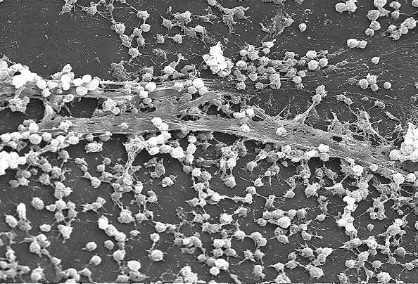 biofilm, formace, lumen, přebývající, katetr, vylučovaný, aureus, staphylococcus, bakterie