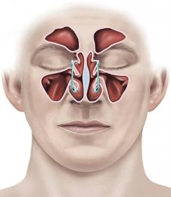 Illustration showing the sinuses.