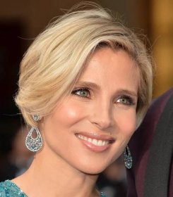Elsa Pataky Nose Job Plastic Surgery Before and After