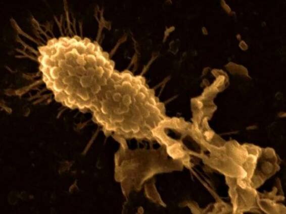 Naděje na účinnější antibiotika ukrytá v mateřském mléce