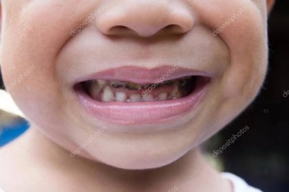 Asijské boy úsměv s zkažené zuby